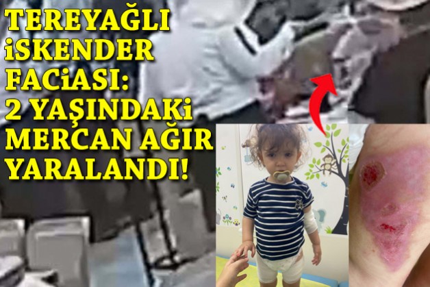 İzmir'de tereyağlı iskender faciası: 2 yaşındaki Mercan ağır yaralandı!