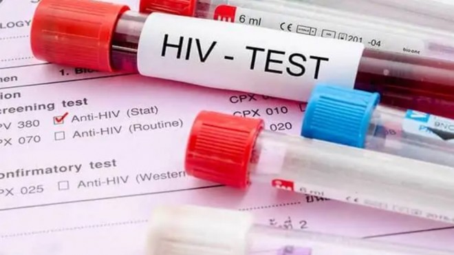 İzmir’de ücretsiz ve anonim test merkezi 2'ye çıktı
